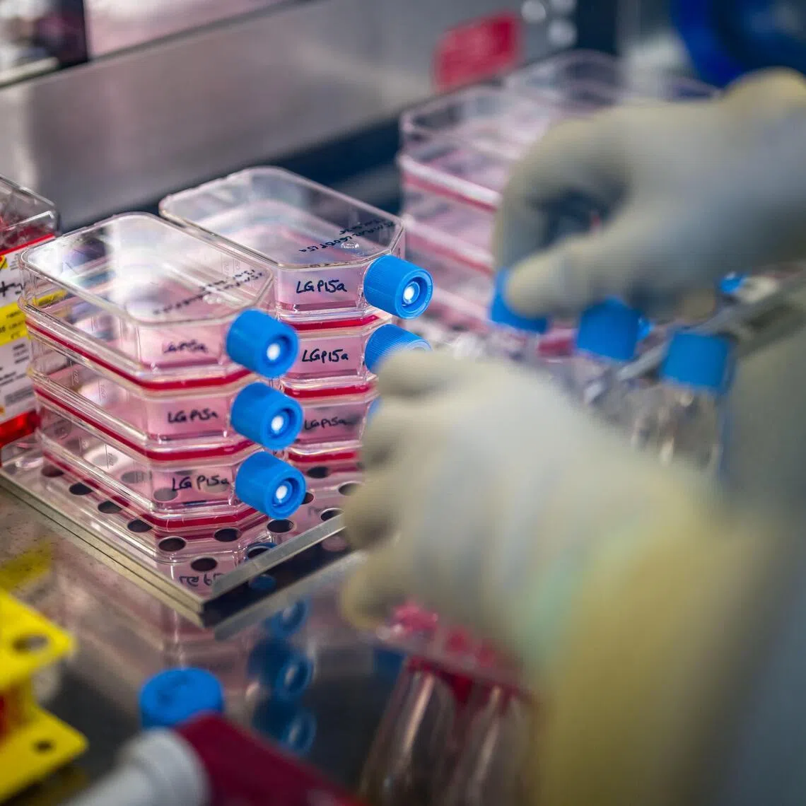 A biomedical analyst works at the cell production centre of the Lausanne University Hospital (CHUV) in Epalinges, Switzerland. 