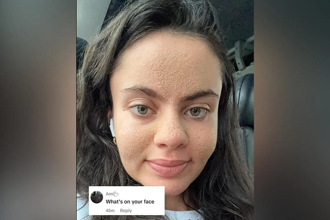 Tia Zakher is a 22-year-old woman known on TikTok for a skincare routine that involves doing nothing to her skin – not even washing it.