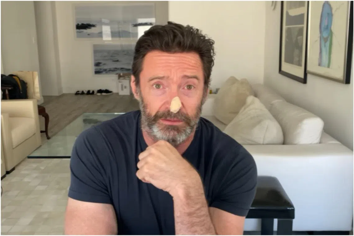 The 54-year-old Wolverine star, who had a plaster on his nose, said he had just undergone two biopsies.