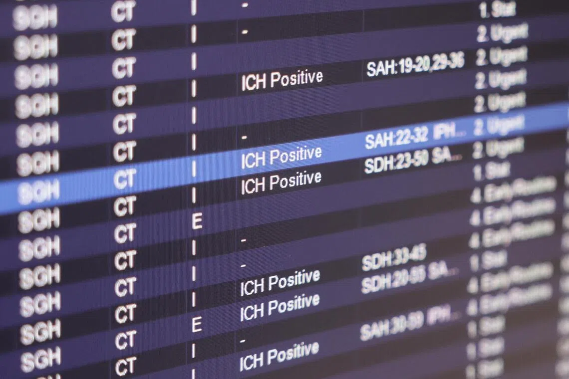 Scans which were picked up as positive for bleeding in the brain, or intracranial haemorrhage (ICH), by the AI tool would be clearly marked as “ICH positive”, whereas other scans will not show a reading.