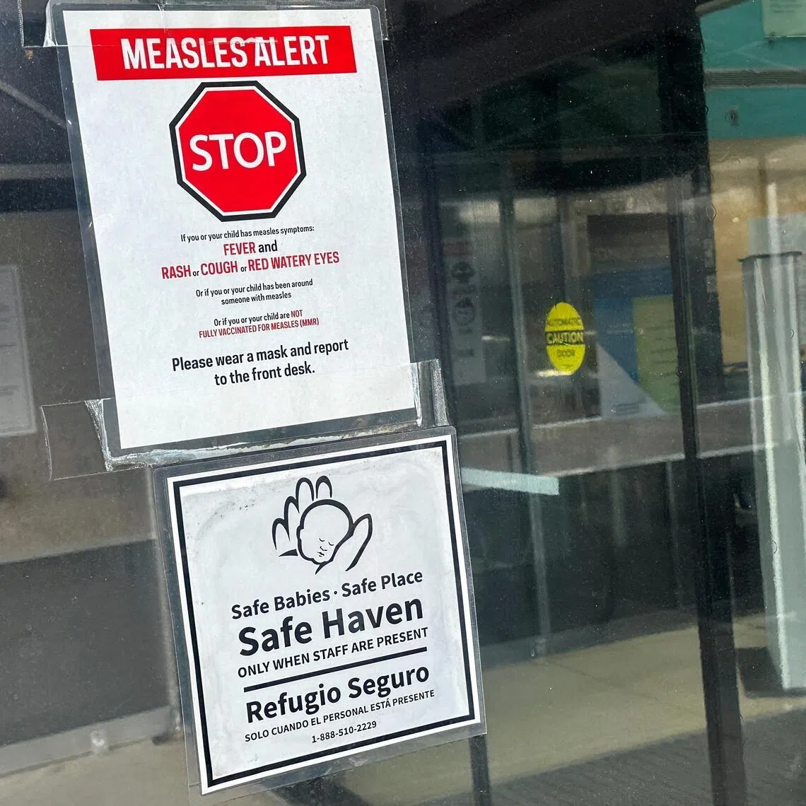 Measles is highly contagious and can lead to encephalitis and pneumonia.