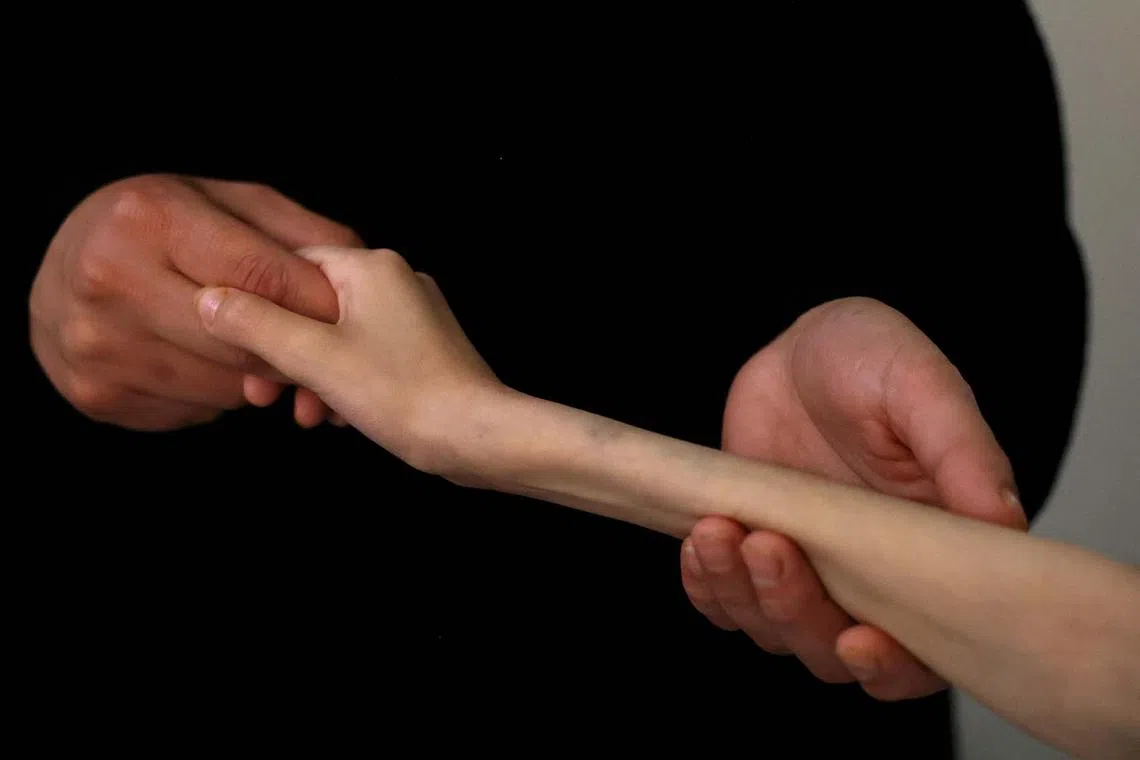 A malnourished Palestinian child from Gaza, Rahaf Ayyad, 12, is held by her mother, Shorouk Ayyad, at the Sheikh Khalifa Medical City, where she receives medical treatment in Abu Dhabi, United Arab Emirates, May 19, 2025. 