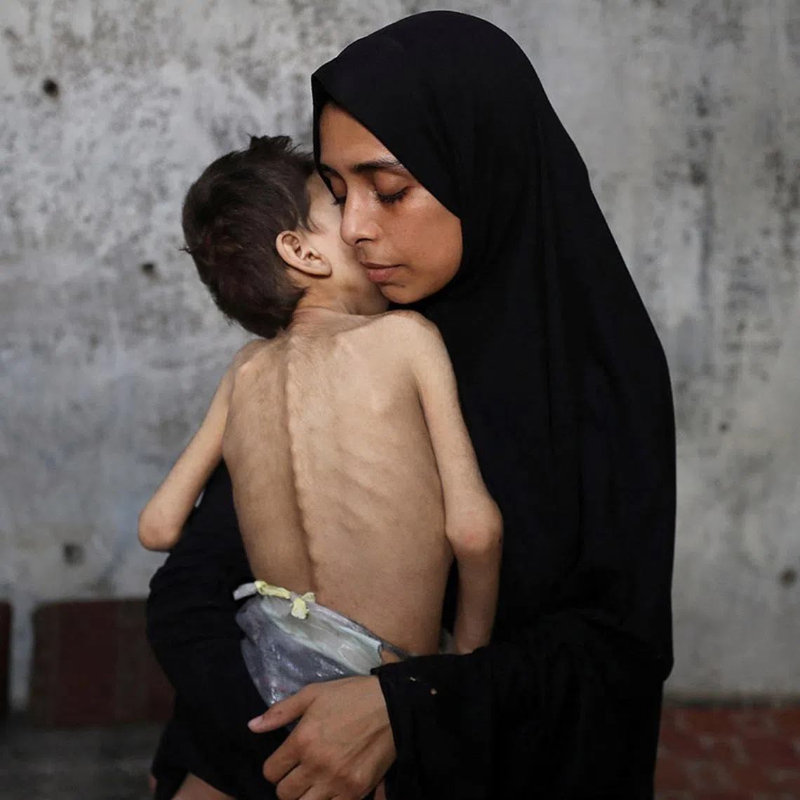 Displaced Palestinian mother Samah Matar holds her malnourished son Youssef, who suffers from cerebral palsy, at a school where they shelter amid a hunger crisis, in Gaza City, July 24, 2025. REUTERS/Mahmoud Issa TPX IMAGES OF THE DAY