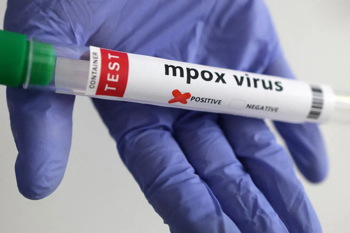 FILE PHOTO: A test tube labelled \"Mpox virus positive\" is held in this illustration taken August 20, 2024. REUTERS/Dado Ruvic/Illustration/File Photo