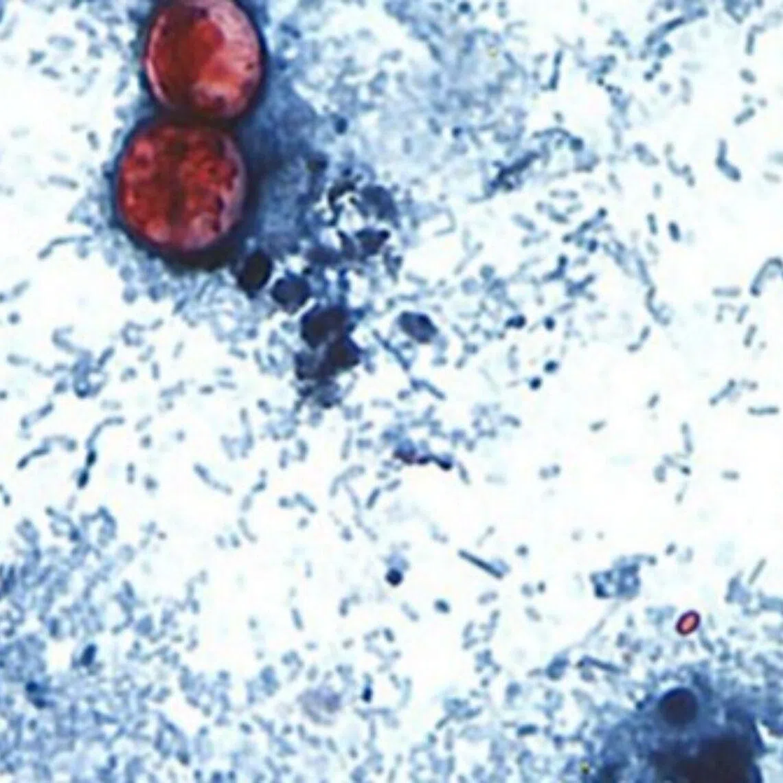 Cyclospora is a microscopic parasite that causes Cyclosporiasis, a severe gastrointestinal illness. It is transmitted through contaminated food and water.