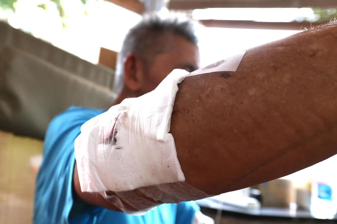 SM20240414-ChangKB02/庄耿闻/严思莹/ 打架事件,有人被砍伤 (85 Redhill FC )