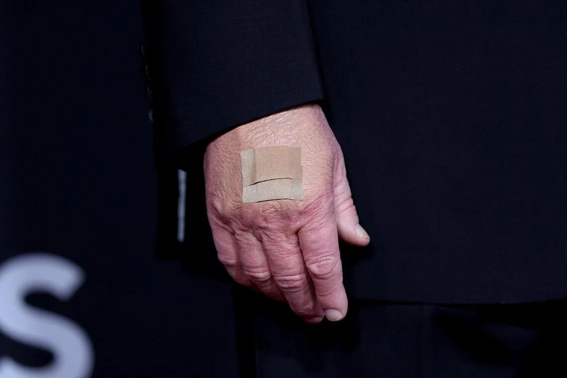 US President Donald Trump's hand as he poses on the red carpet at the John F. Kennedy Center on Dec 7.