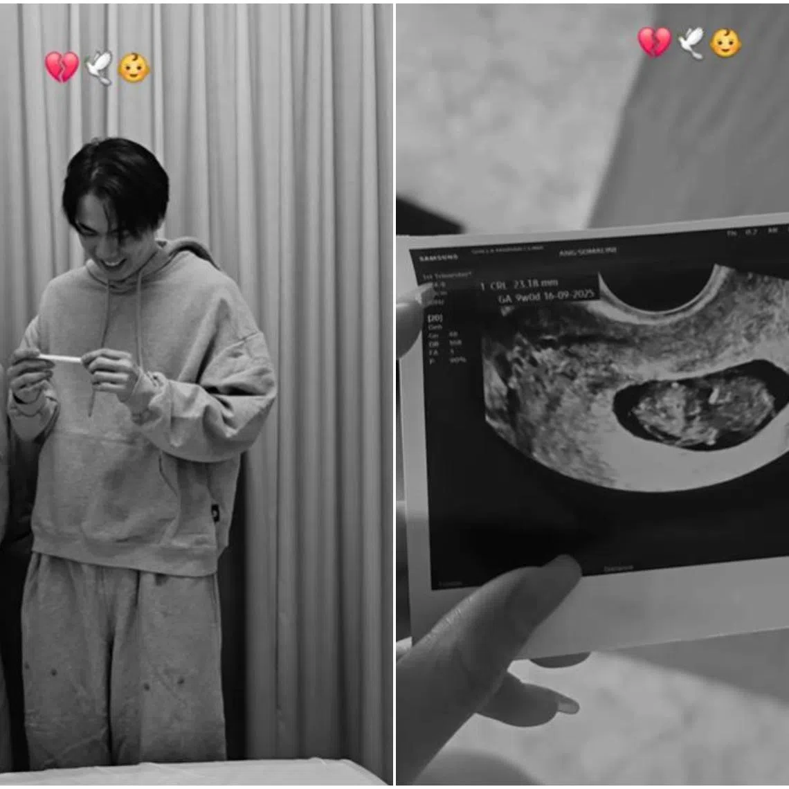 Local celebrity couple Hong Ling and Nick Teo revealed on Mother's Day that they recently suffered a miscarriage.