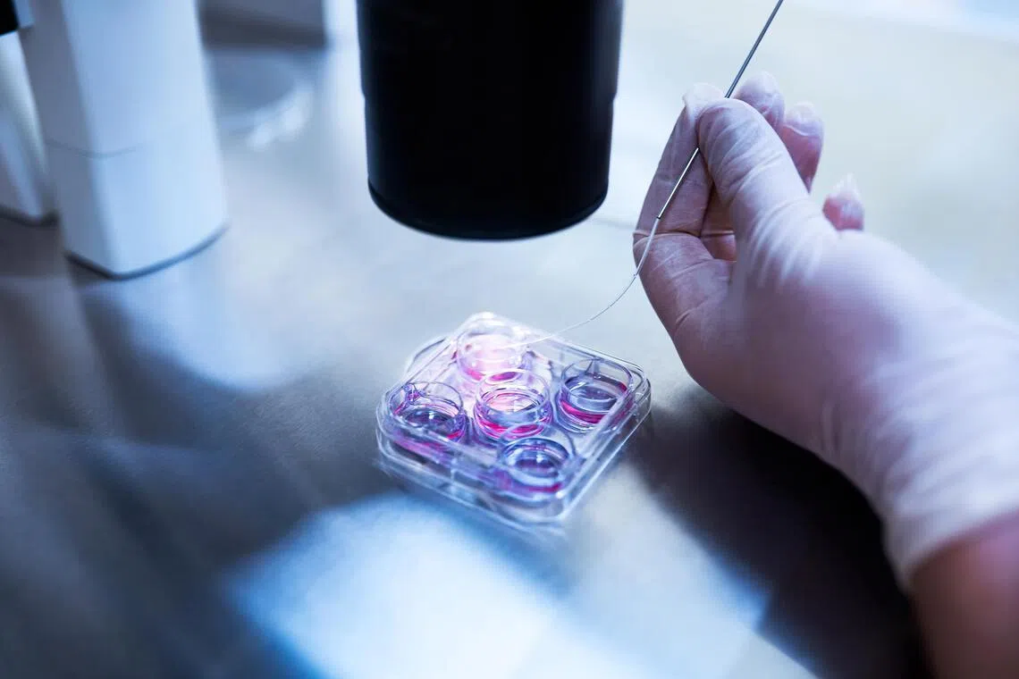 O processo de inseminação artificial de óvulos em uma clínica de fertilização in vitro. O primeiro bebê de fertilização in vitro nasceu em 1978.