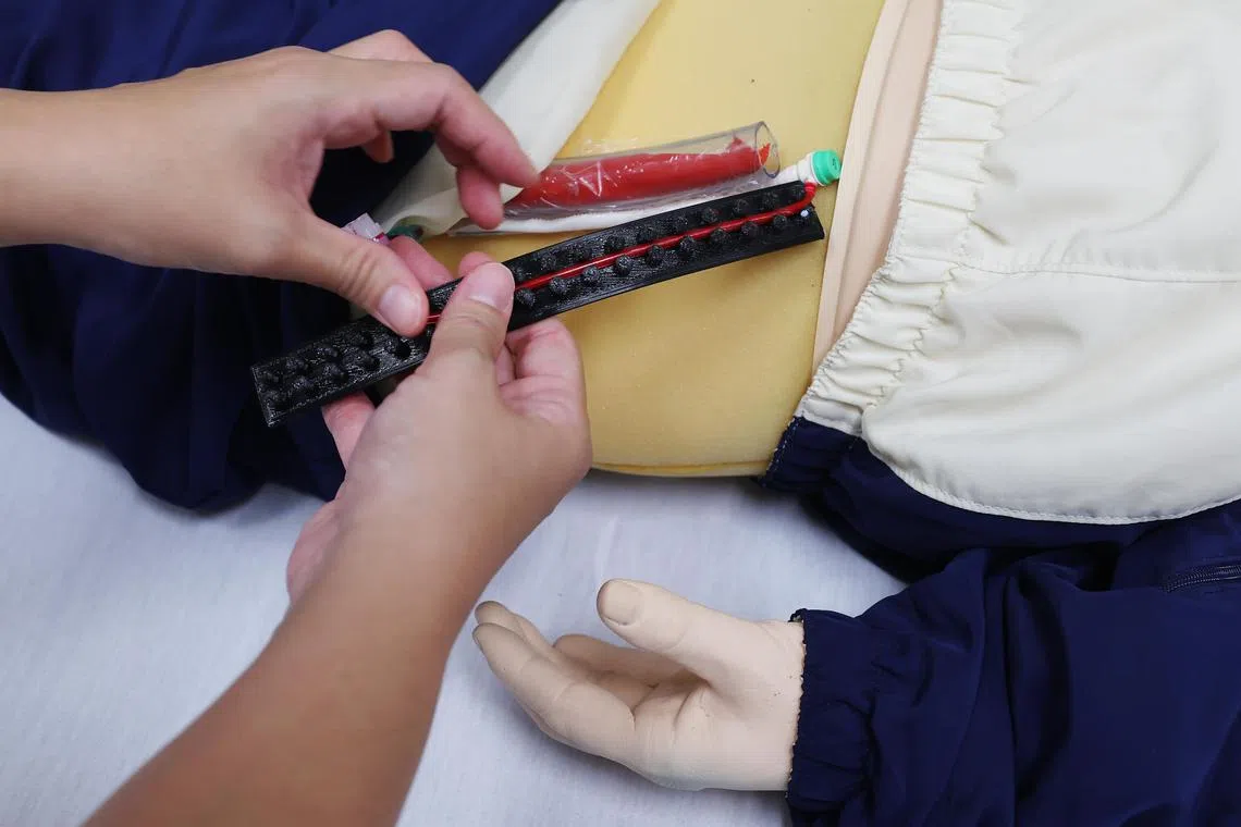 CMG20240711-ChuaKT02 蔡家增/卢慧菁　访国家心脏中心医生护士有关smart device in ECMO patients　[国家心脏中心 NHCS level 7 (lift lobby C) 5 Hospital Dr, Singapore 169609] DPC Organizer (black rubberized band) helps to secure the distal perfusion catheter tubing and thus prevent kink which might lead to complications such as stroke, hemorrhage and infection etc. 
Profile of Dr Hong RiLong and Charmaine Ong, assistant nurse clinician who worked on the project.  