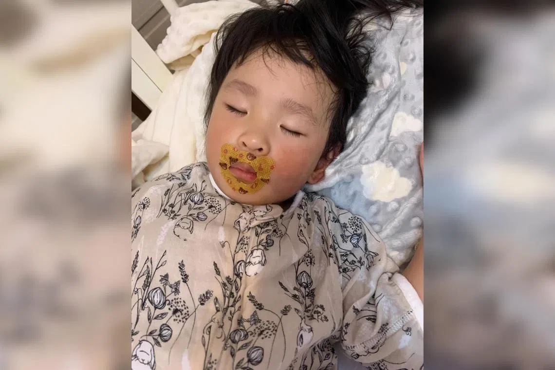 Mouth tape has been promoted as a way to prevent children from “turning ugly due to parents’ negligence”.