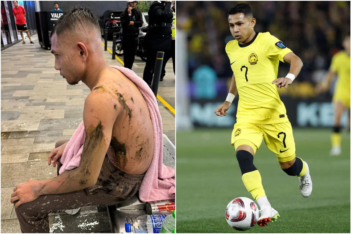 Faisal Halim had a three-hour skin allograft surgery on May 20 which went "better than expected".