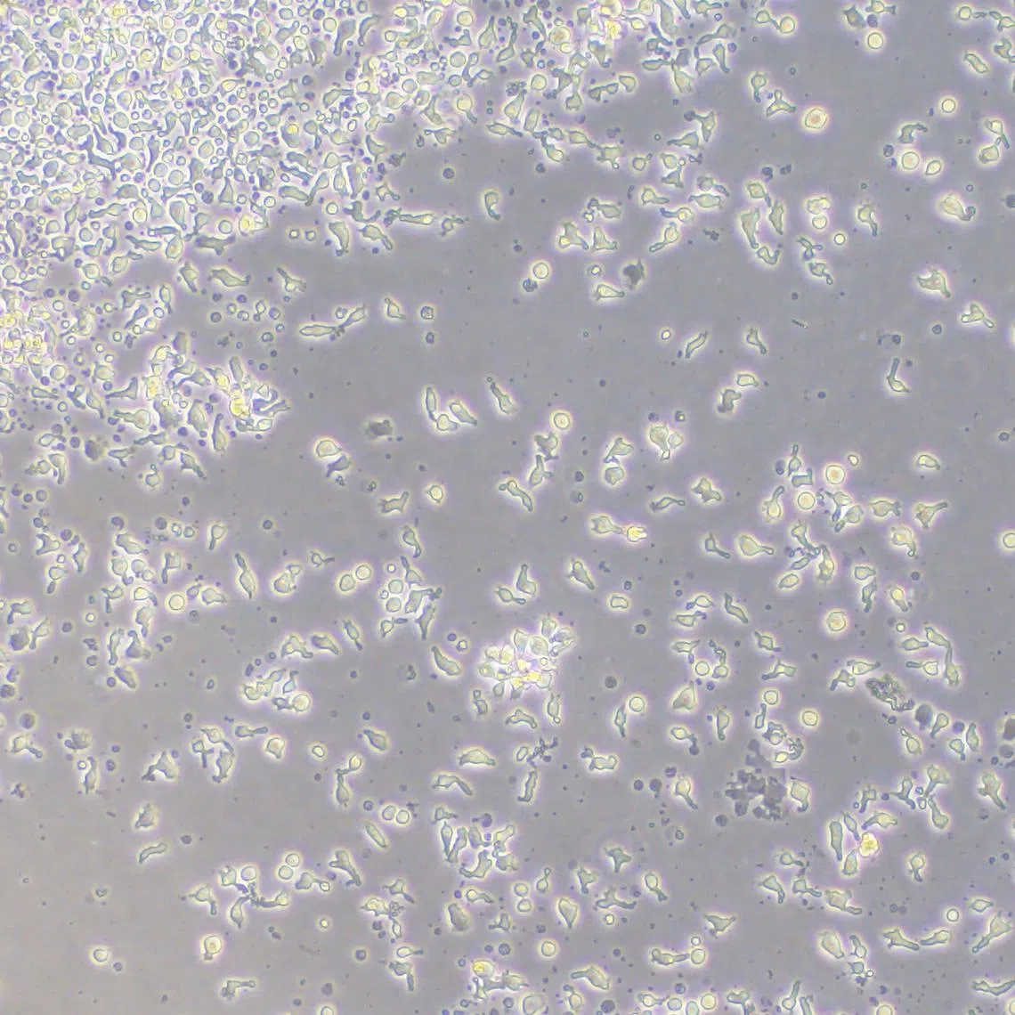 T-cells used in CytoMed's new allogeneic CAR-T therapy.