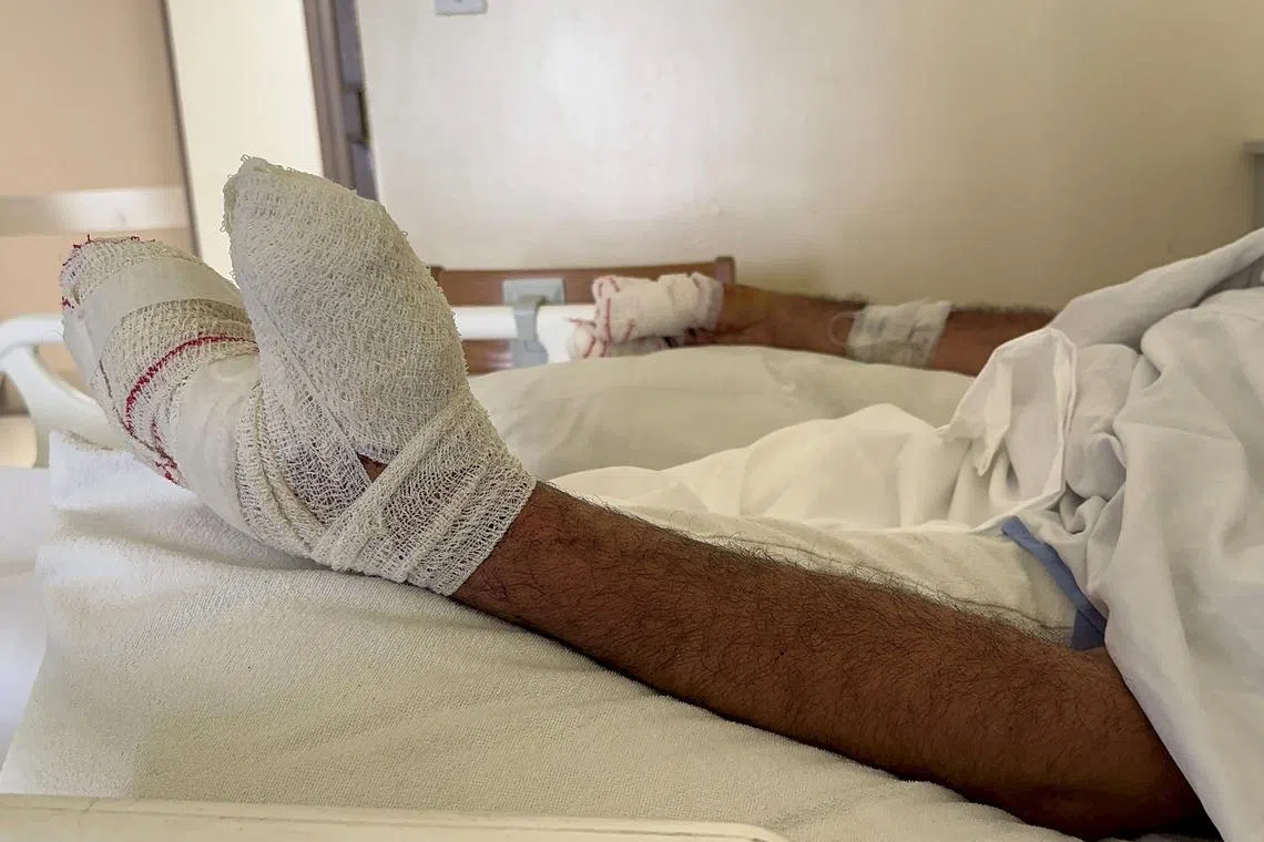 FILE PHOTO: A man, who was wounded when pagers used by Hezbollah detonated on Tuesday across Lebanon, receives treatment at Sidon Governmental Hospital, in Sidon, Lebanon September 20, 2024. REUTERS/Ali Hankir/File Photo