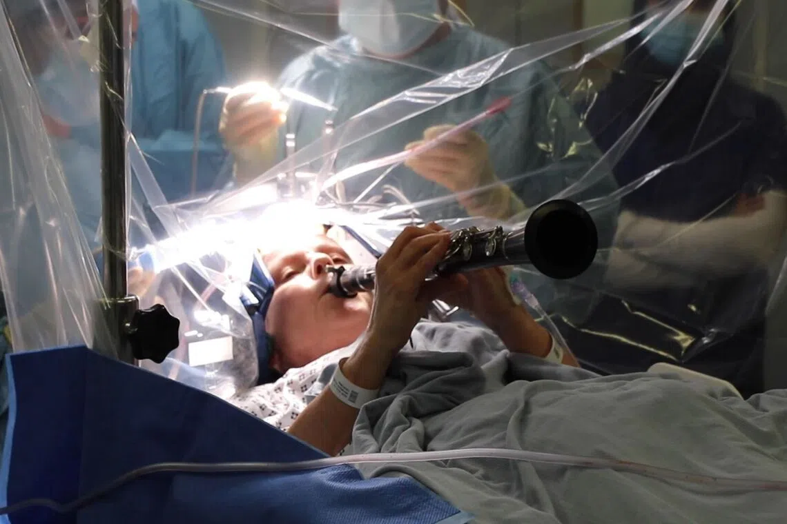 British patient with Parkinson’s disease plays clarinet while undergoing brain surgery