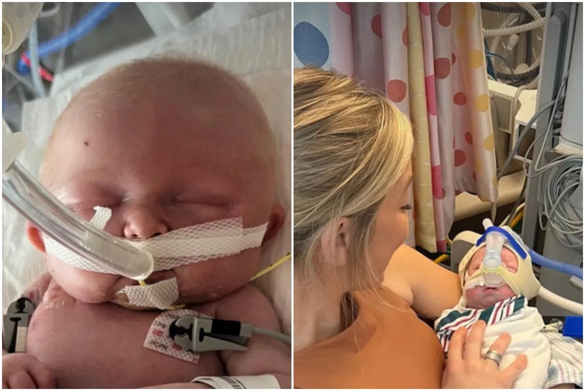 KJ had a rare genetic disorder, CPS1 deficiency, that affects just one in 1.3 million babies.