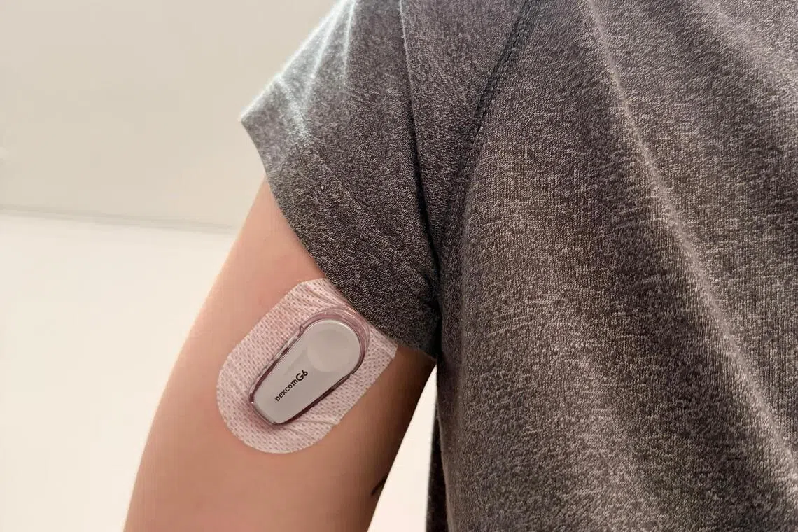 Ms Ng Zhuang Shu, who has monogenic diabetes, uses the Dexcom G6 continuous glucose monitoring (CGM) system to monitor her blood sugar levels. This system currently is the only CGM device eligible for government subsidies.