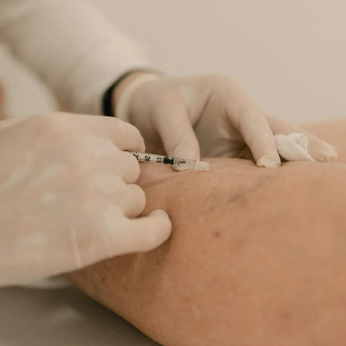 Those who started their vaccination series with HPV2 or HPV4, and are pending further doses, may complete it by receiving the HPV9 vaccine.