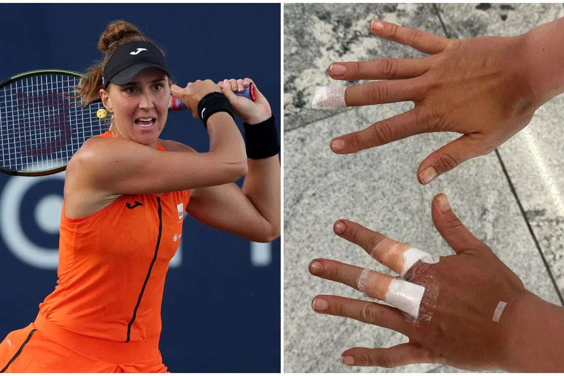 Brazil’s Beatriz Haddad Maia said she needed stitches on both hands.