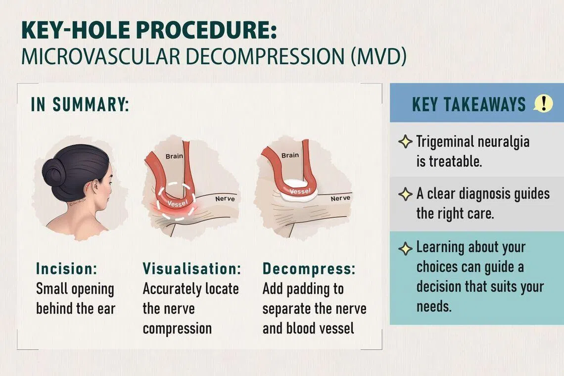 Infographic on microvascular decompression surgery 
