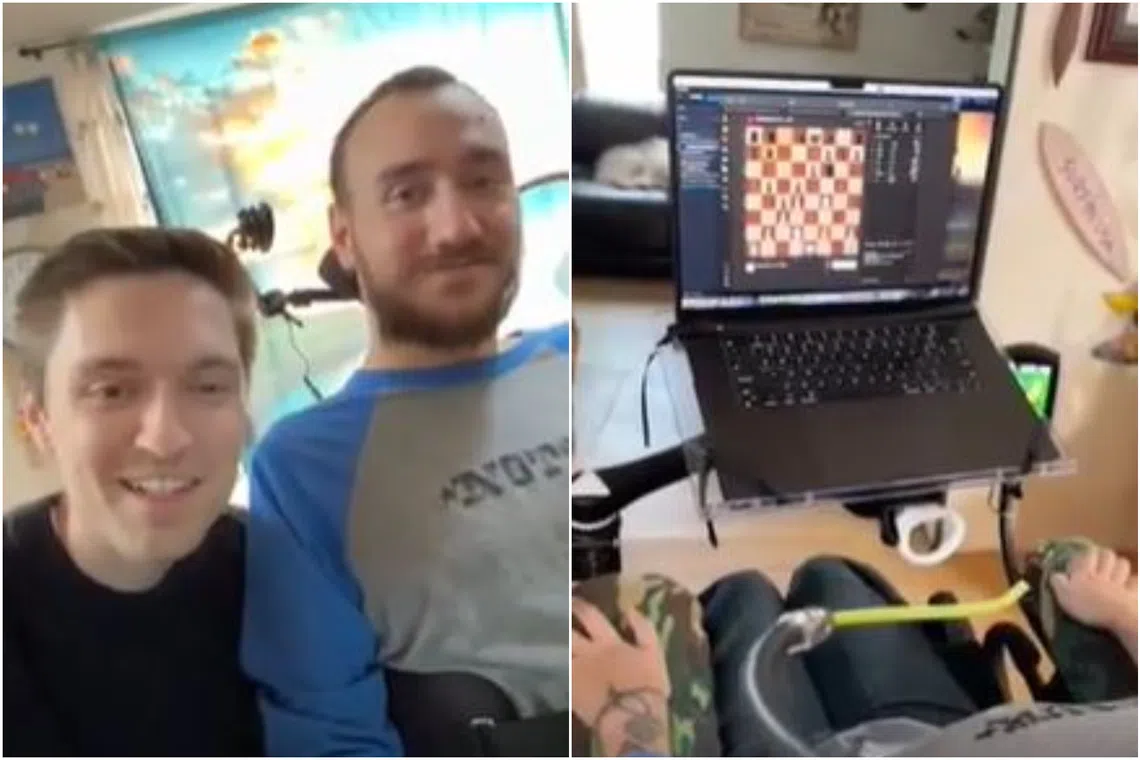 Mr Noland Arbaugh (second from left), who was paralysed below the shoulder after a diving accident, played chess on his laptop and moved the cursor using the Neuralink device.
