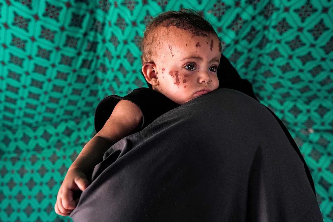 Palestinian toddler Rim Abu Hayya, the sole survivor from her family after they were killed by reported Israeli bombardment that hit their house in the east of Khan Yunis, is carried by her aunt Ayat in a tent shelter west of Khan Yunis in the southern Gaza Strip on Aug 13, 2024.