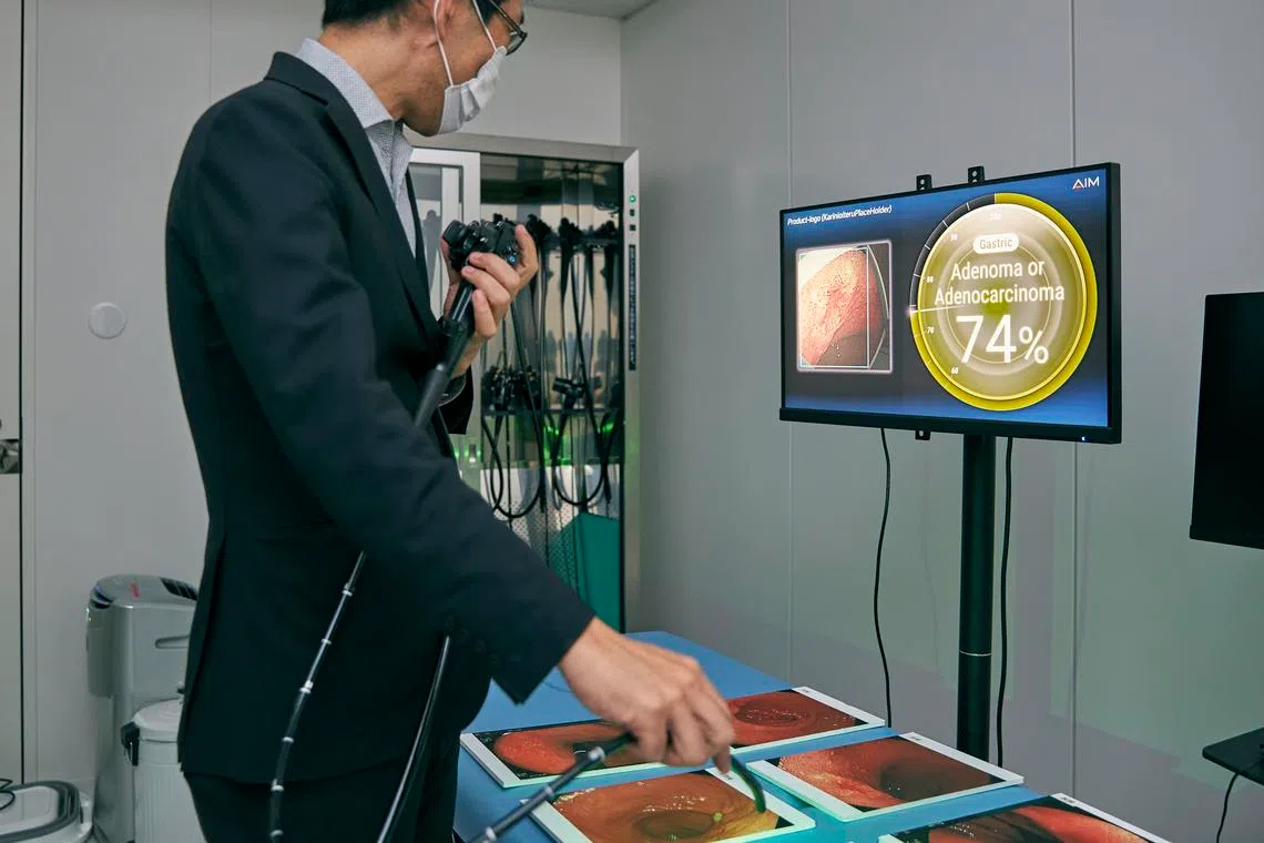 gastroai endoscopy gastroscopy by ai medical service detect gastric cancer early