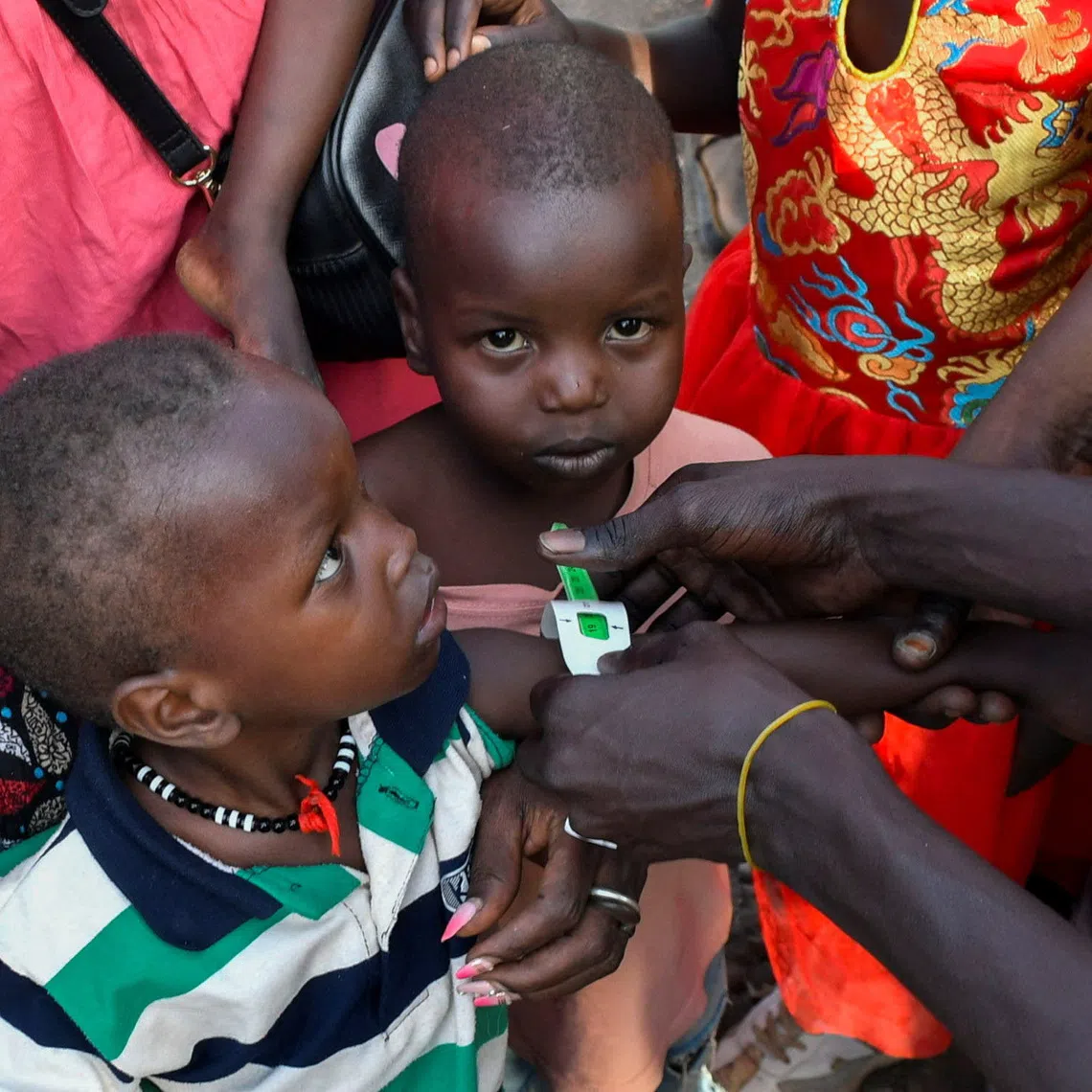 FILE PHOTO: Children are examined for malnutrition, as civilians who fled the war-torn Sudan following the outbreak of fighting between the Sudanese army and the paramilitary Rapid Support Forces (RSF) gather to register at the United Nations High Commissioner for Refugees (UNHCR) after crossing at the Joda South border point, in Renk County, Upper Nile state, South Sudan, April 30, 2023. REUTERS/Jok Solomun/File Photo