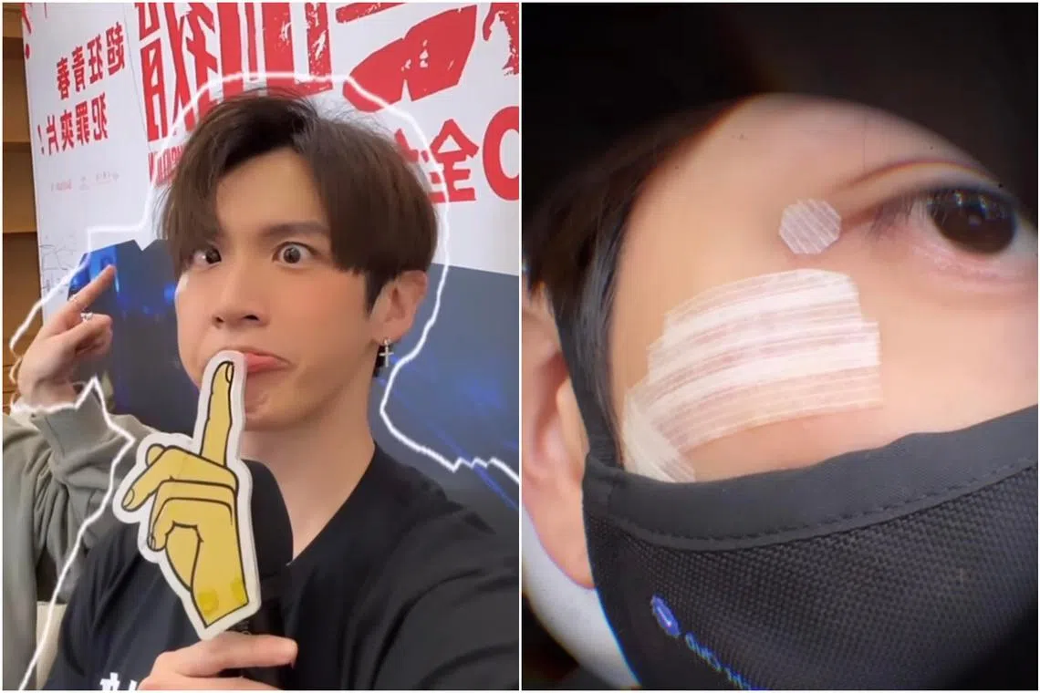 Taiwanese actor Kai Ko received 20 to 30 stitches and took time off to recover.