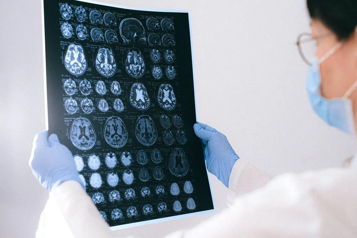 The Belgian boy is the first child in the world to have been cured of brainstem glioma.