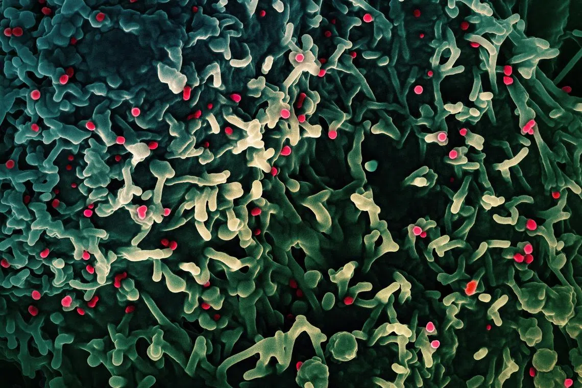 FILE PHOTO: An undated colorized scanning electron micrograph of mpox virus (red) on the surface of infected VERO E6 cells (green), captured at the National Institute of Allergy and Infectious Diseases (NIAID) Integrated Research Facility (IRF) in Fort Detrick, Maryland.  NIAID/Handout via REUTERS