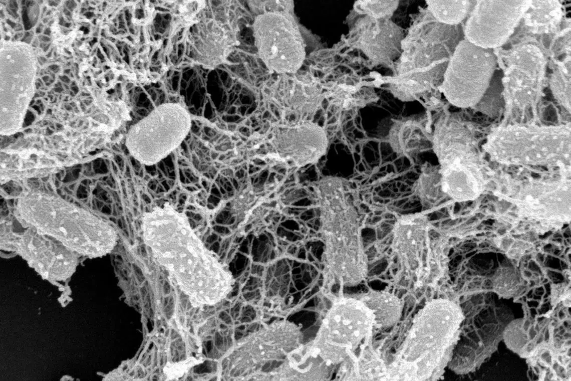 Antibiotic-resistant E. coli entrapped by peptide nanonets. Antimicrobial resistance is projected to kill 10 million by 2050.