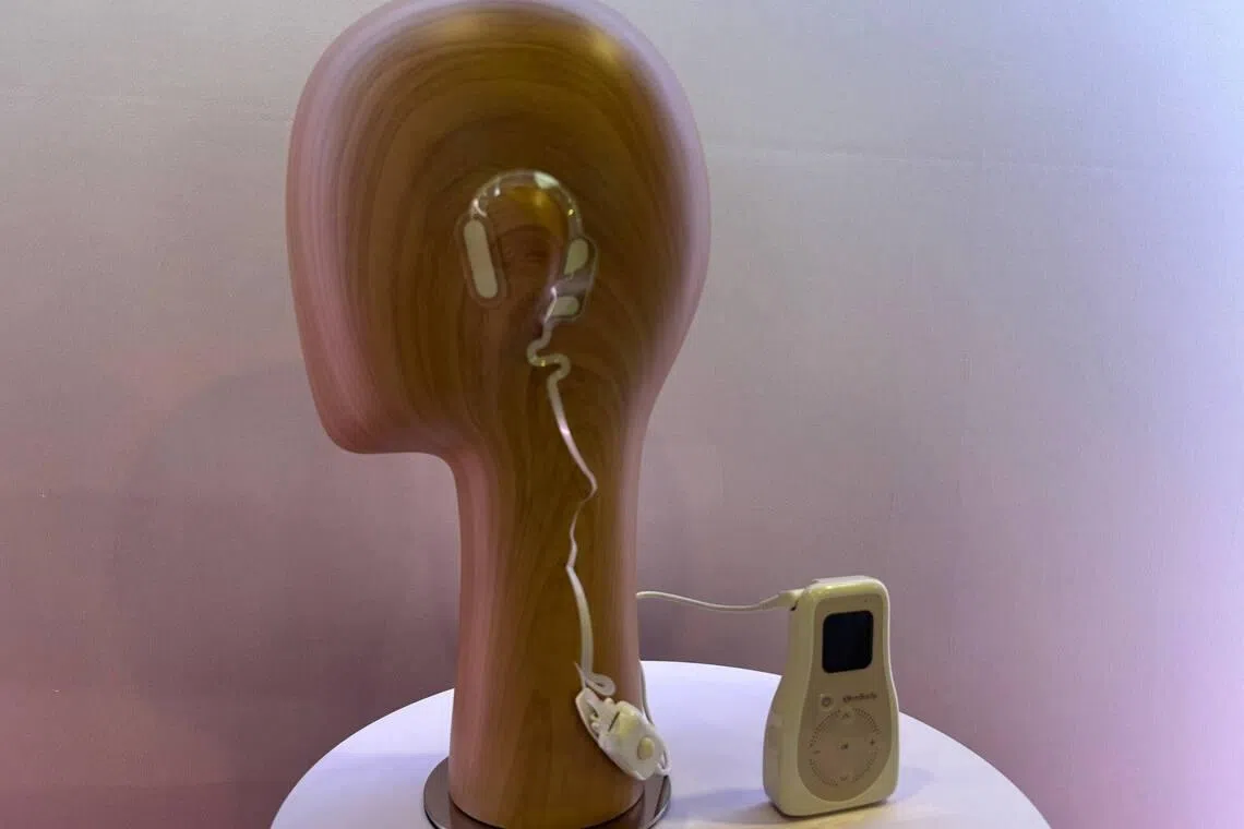 The patches by OhmBody are stuck on the front and back of one ear, where the vagus and trigeminal nerves are located.