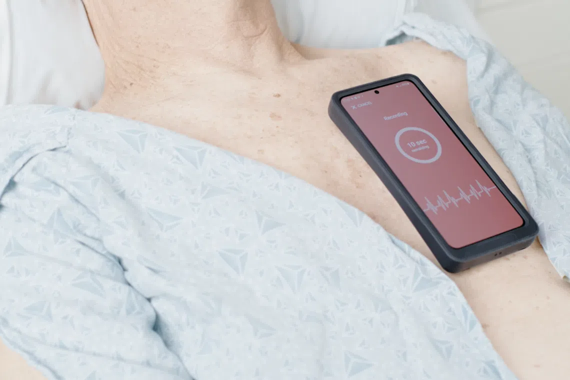 non invasive heart catheterization to measure cardiac pressure with acorai device