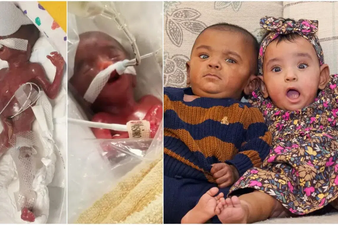 Adiah and Adrial Nadarajah were born on March 4, 2022 at the gestational age of 22 weeks, or 126 days early.