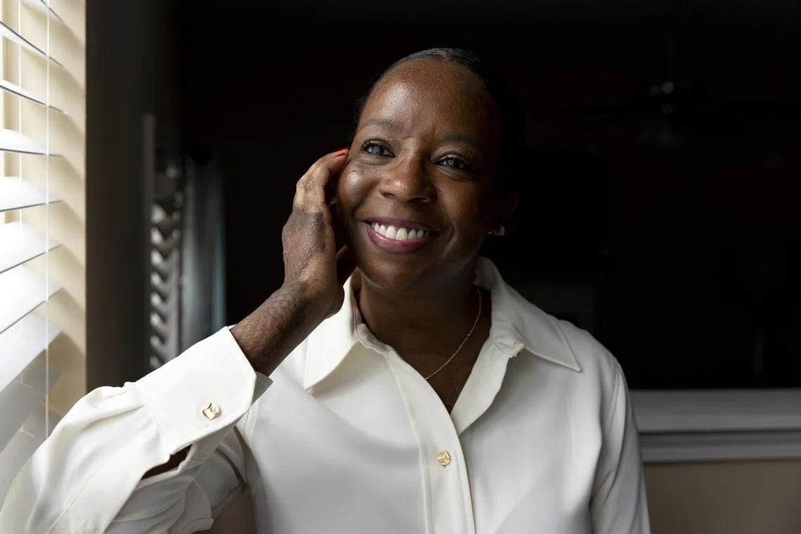 Doctors used placenta-derived grafts on Marcella Townsend’s face after a propane explosion in 2021.