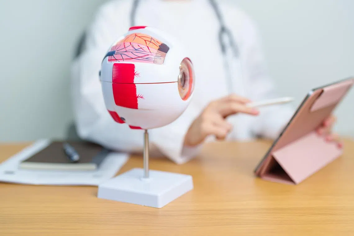 Glaucoma affects up to 5 per cent of the population over 50 in Singapore