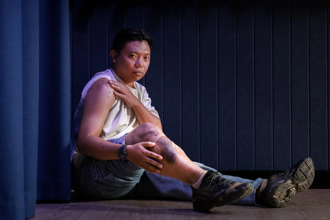 I thought I’d never walk again: Biker crushed between 2 cars in 2021 Tampines drink-driving crash