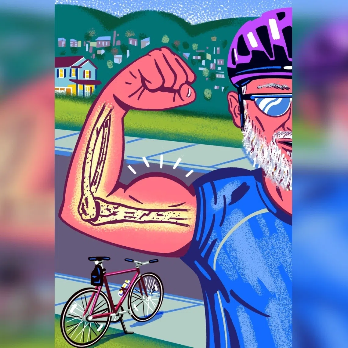 More men are now living long enough to develop osteoporosis. 