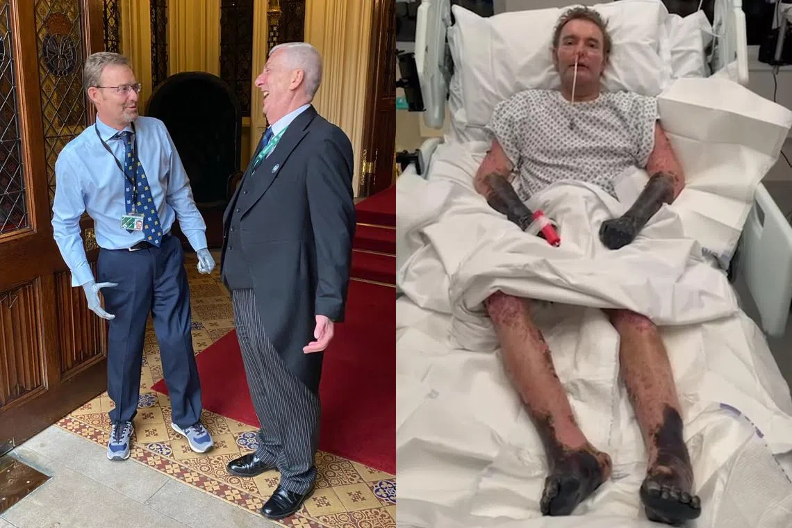 British lawmaker Craig Mackinlay returned to Parliament on May 22 after suffering from sepsis that resulted in his hands and feet being amputated.
