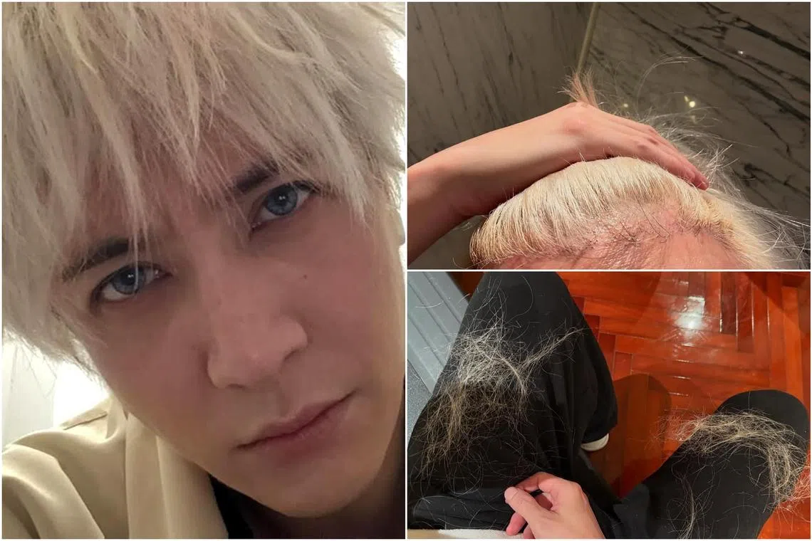 Joker Xue shared photos of his hair loss, with his legs covered in clumps of dyed hair.