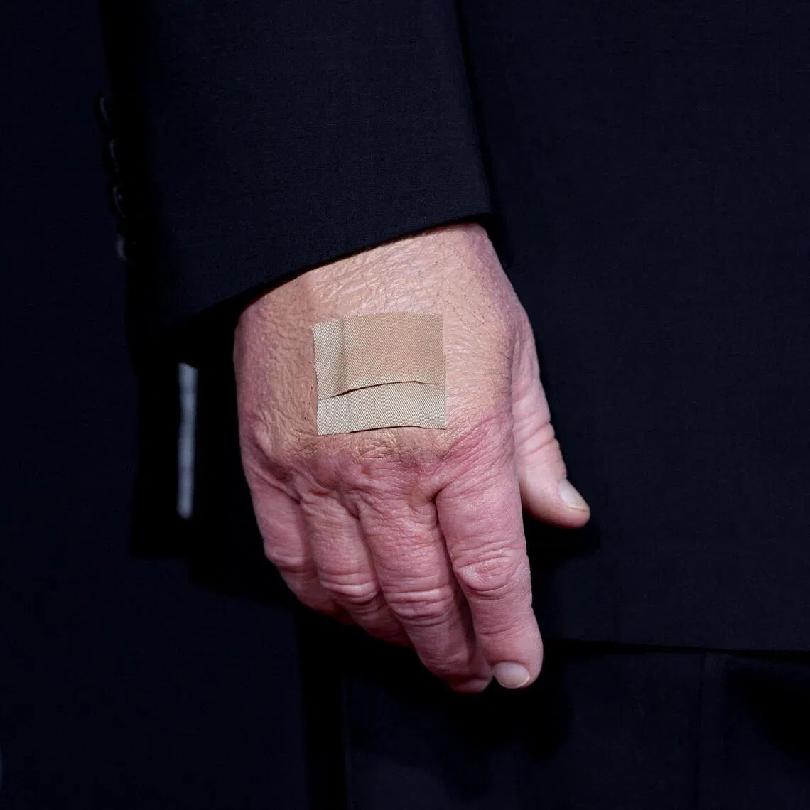 US President Donald Trump's hand as he poses on the red carpet at the John F. Kennedy Center on Dec 7.