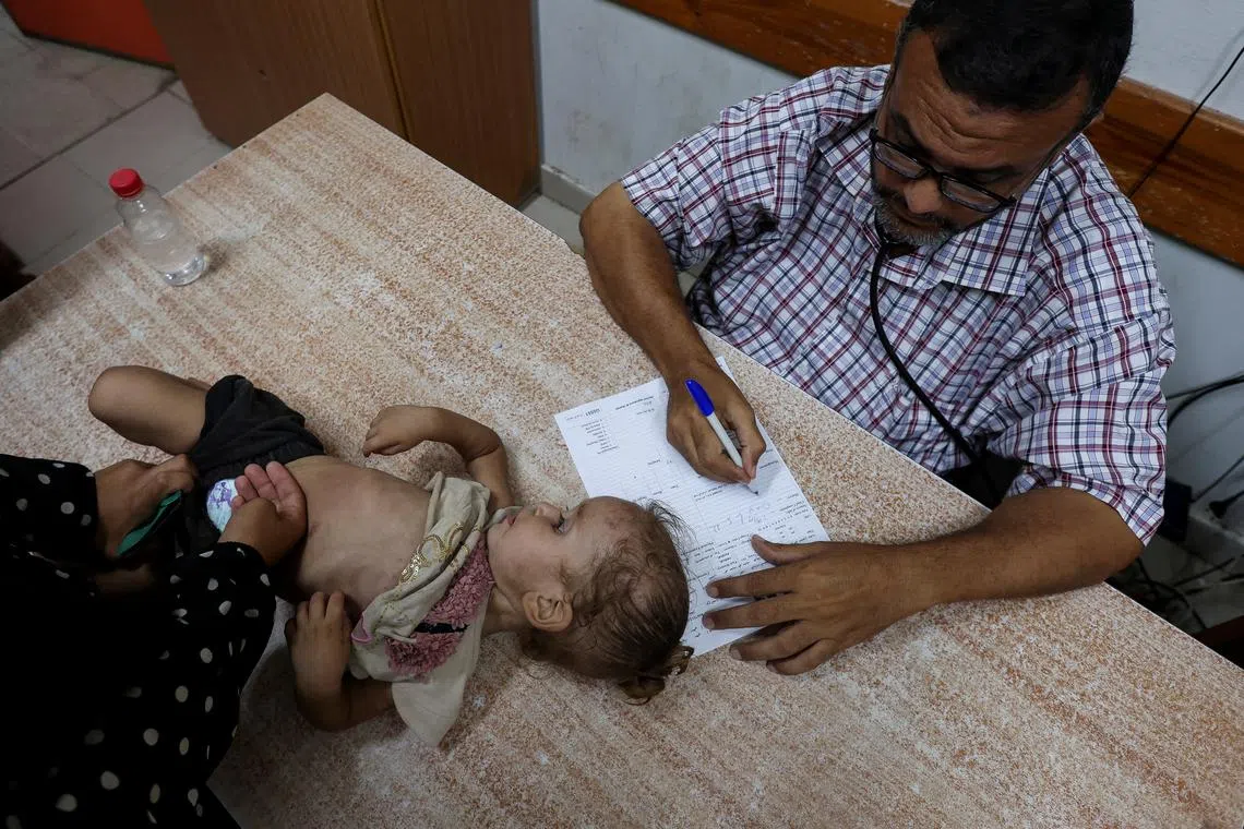 FILE PHOTO: A Palestinian girl is examined by a doctor amid fears over the spread of polio after the first case was reported by the Ministry of Health, as the conflict between Israel and Hamas continues, at Al-Aqsa Martyrs Hospital, in Deir Al-Balah in the central Gaza Strip, August 18, 2024. REUTERS/Ramadan Abed/File Photo