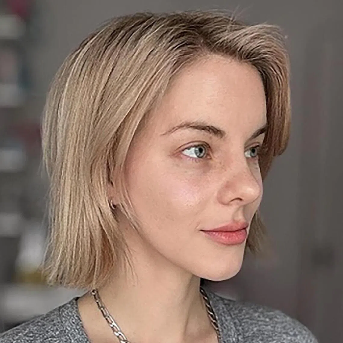 Ms Heidi Mae’s appearance before and after her facelift, nose surgery and skin procedures. 