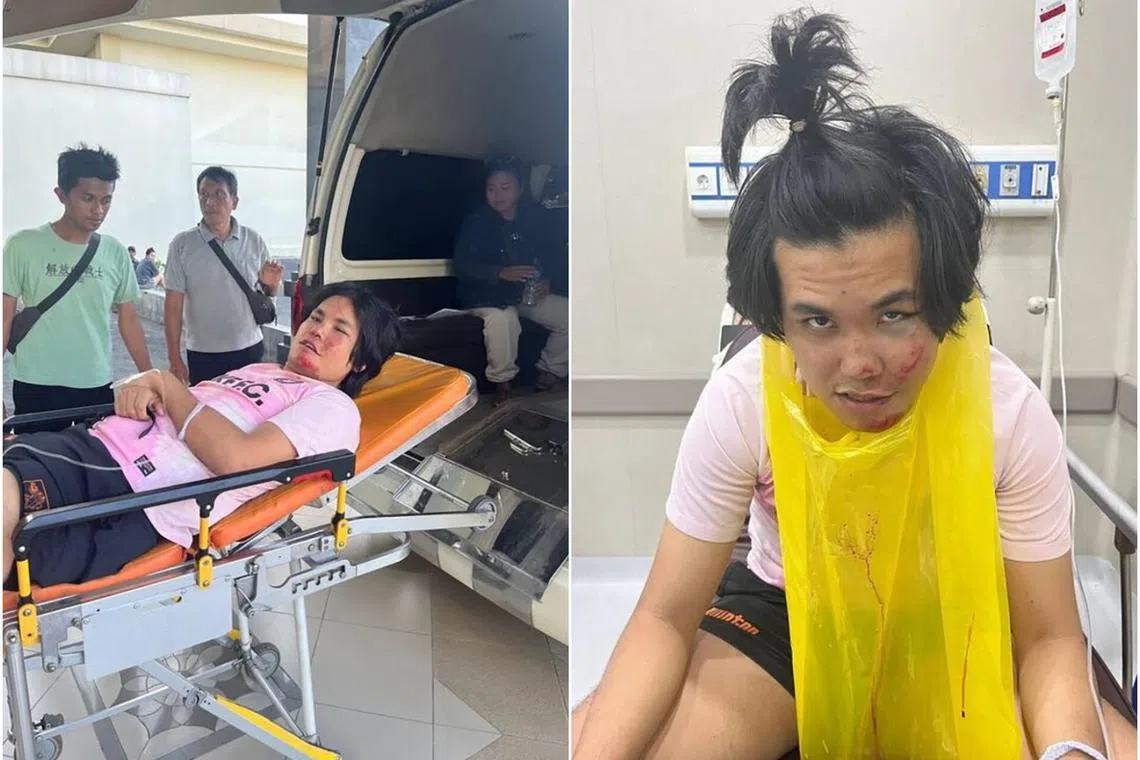 Mr Cheng Yu Heng experienced temporary memory loss as well as a fractured cheek.