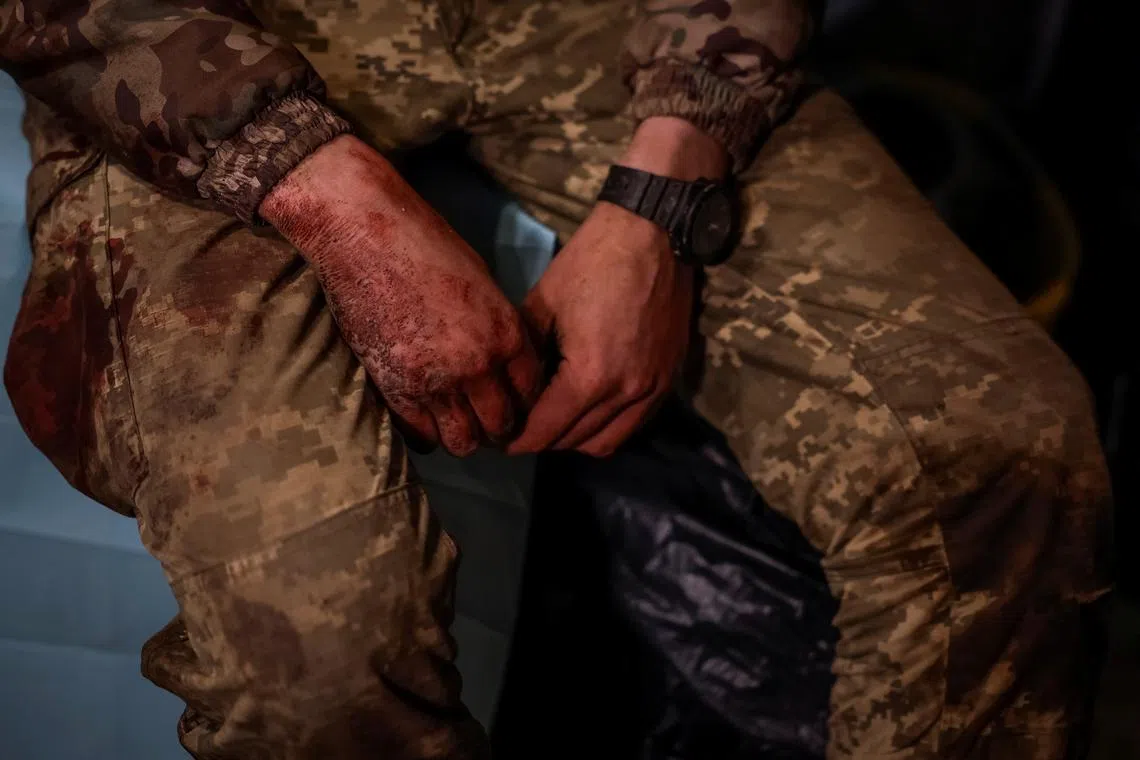 Yurii, 33-years-old, a wounded Ukrainian service member of the 128th Separate Mountain Assault Transcarpathian Brigade of the Armed Forces of Ukraine, sits at a medical stabilisation point, amid Russia's attack on Ukraine, in Zaporizhzhia region, Ukraine May 10, 2025. REUTERS/Alina Smutko
