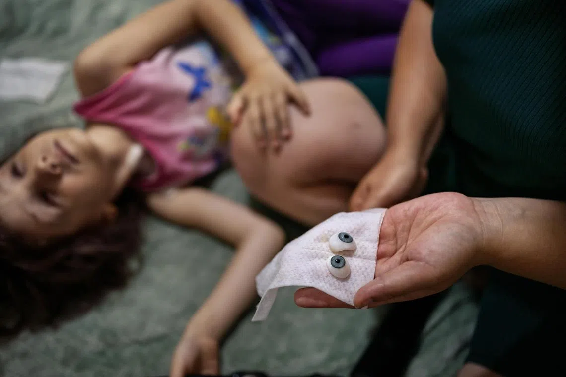 The prosthetic blue eyes that Sonya Liakh, aged 5 and in palliative cancer care, had asked for to replace her own hazel-green eyes, the original source of cancer now ravaging her body, at the City of Goodness shelter in Chernivtsi, Ukraine, June 28, 2024. Blinded by cancer, Sonya learned to navigate her world under the watch of her mother and the guidance of her big sister, Valeria. (Lynsey Addario/The New York Times) Ñ NO SALES 