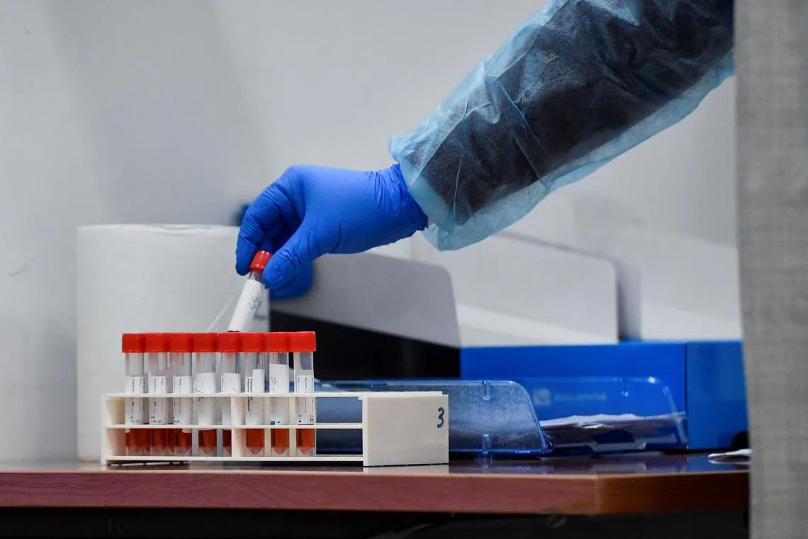 PCR tests are sensitive and are bound to yield many positive cases from countries that are experiencing a big wave.