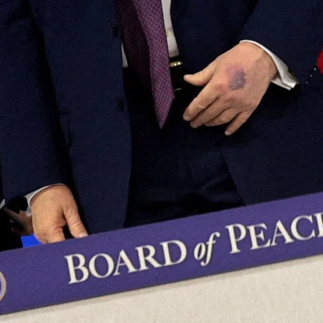 The images of Mr Trump's bruised left hand, taken while he was at an inaugural ceremony for his global “Board of Peace” initiative, quickly spread on social media.