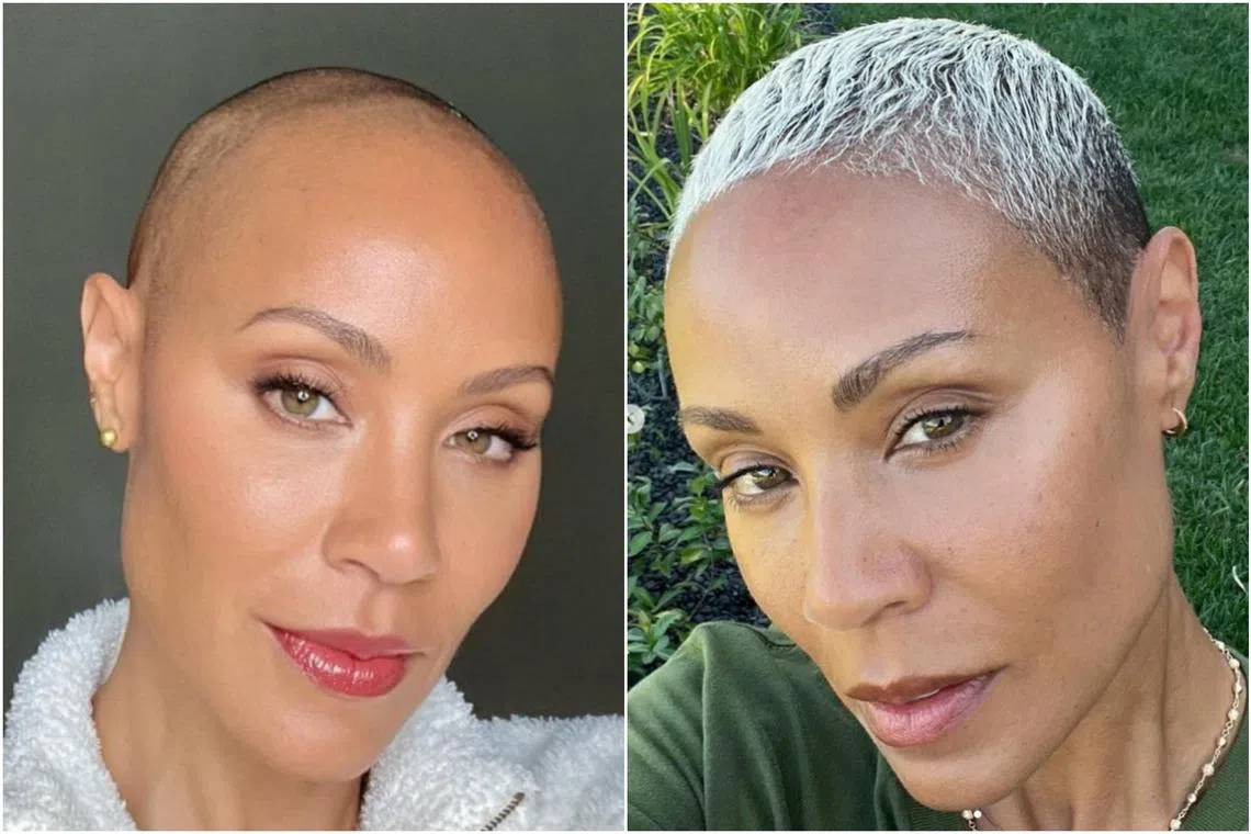 Actress Jada Pinkett Smith, who is battling alopecia, shared "past" and "present" selfies of her hair on Instagram.